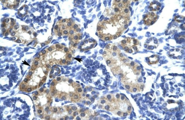 SIX6 Antibody in Immunohistochemistry (IHC)