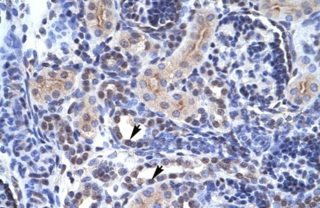 TAF1 Antibody in Immunohistochemistry (IHC)