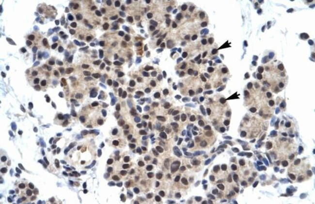 ZNF318 Antibody in Immunohistochemistry (IHC)