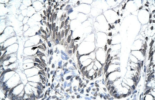 MKX Antibody in Immunohistochemistry (IHC)