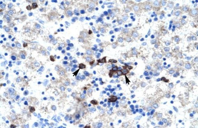 ABT1 Antibody in Immunohistochemistry (IHC)