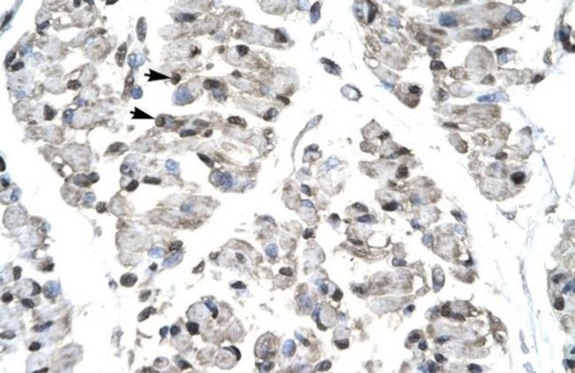 T-bet Antibody in Immunohistochemistry (IHC)