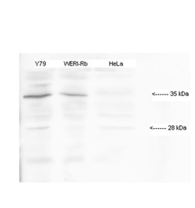 HMX1 Antibody in Western Blot (WB)