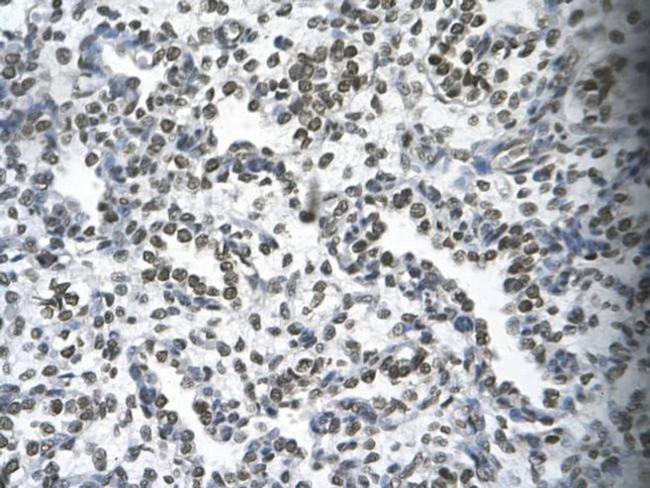 HOXB9 Antibody in Immunohistochemistry (Paraffin) (IHC (P))