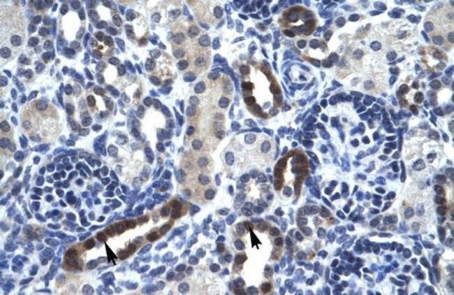 TSFM Antibody in Immunohistochemistry (IHC)
