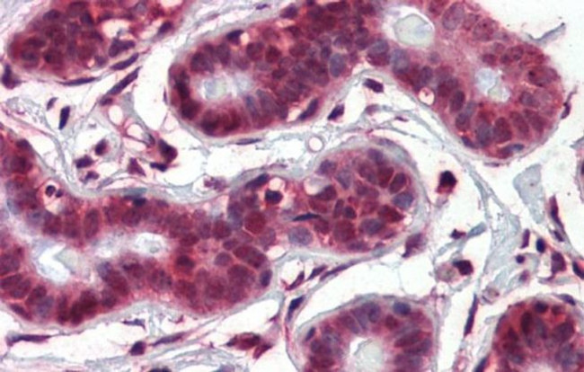 NOTCH4 Antibody in Immunohistochemistry (IHC)