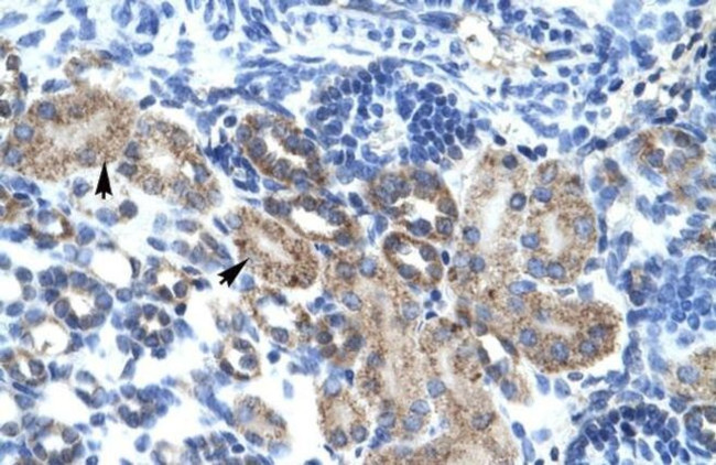 CGI-62 Antibody in Immunohistochemistry (IHC)