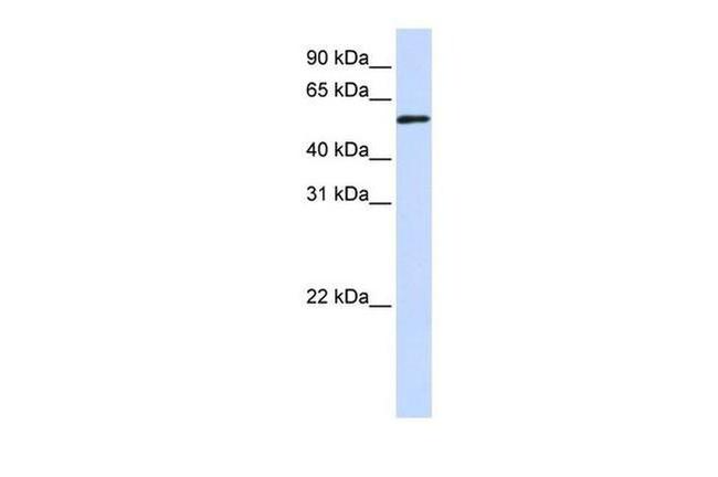 TADA3L Antibody in Western Blot (WB)