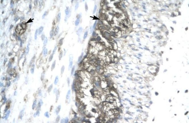ACAT2 Antibody in Immunohistochemistry (IHC)