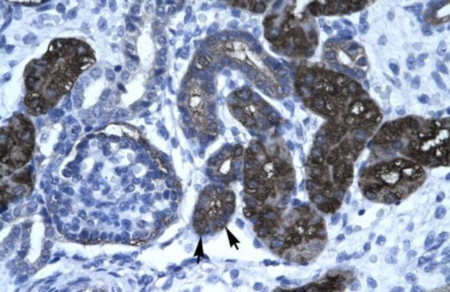 Vasculin Antibody in Immunohistochemistry (IHC)