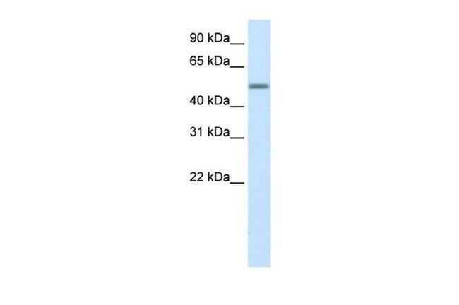 ZNF823 Antibody in Western Blot (WB)