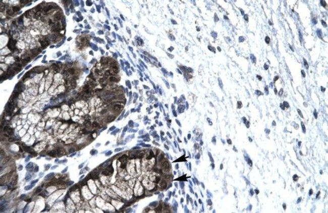 FOXJ2 Antibody in Immunohistochemistry (IHC)