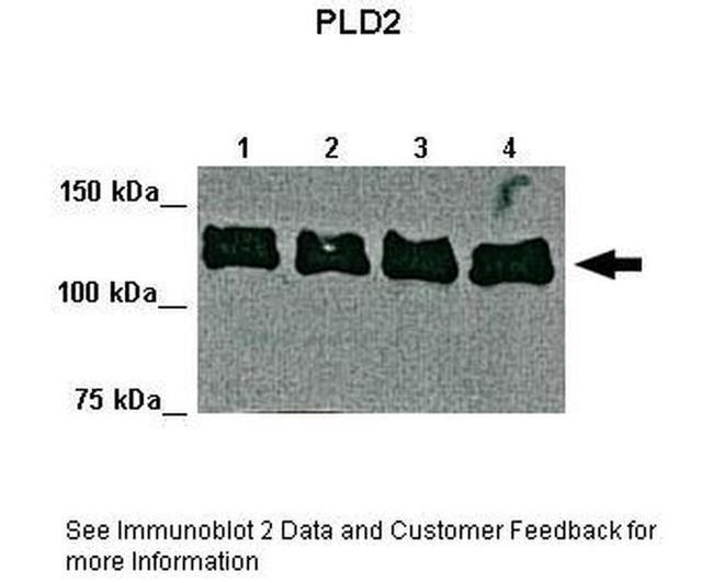 PLD2 Antibody in Western Blot (WB)
