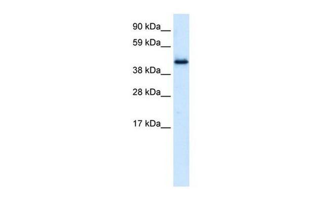 PLRG1 Antibody in Western Blot (WB)