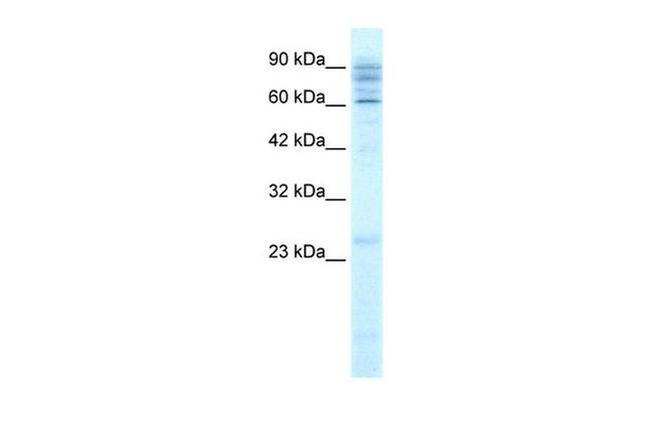 SLC38A2 Antibody in Western Blot (WB)