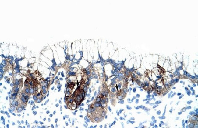 PMF1 Antibody in Immunohistochemistry (IHC)
