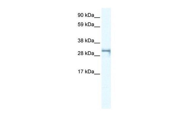 SHOX2 Antibody in Western Blot (WB)