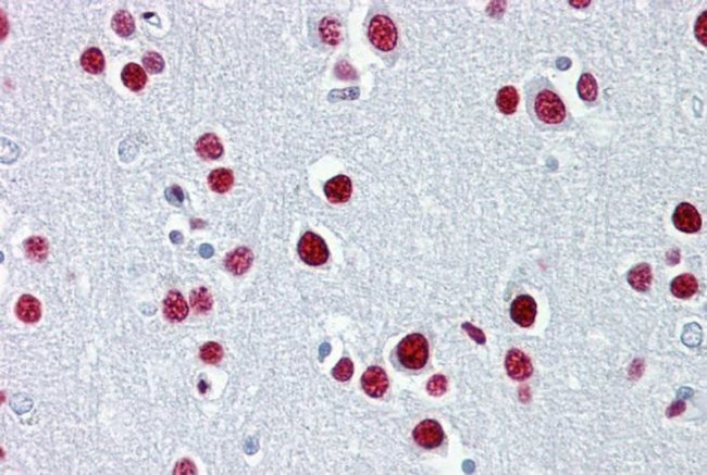 TUB Antibody in Immunohistochemistry (IHC)