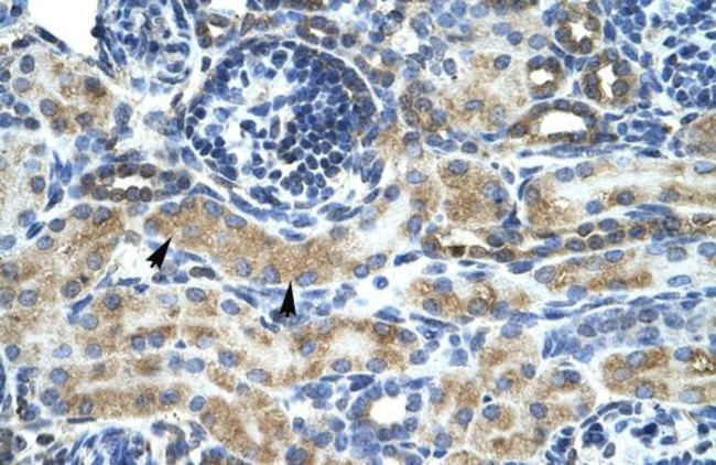 ZNF24 Antibody in Immunohistochemistry (IHC)