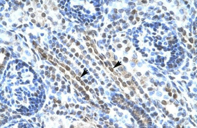 ANKRD11 Antibody in Immunohistochemistry (IHC)