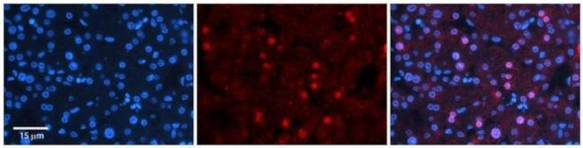 ZNF236 Antibody in Immunohistochemistry (Paraffin) (IHC (P))