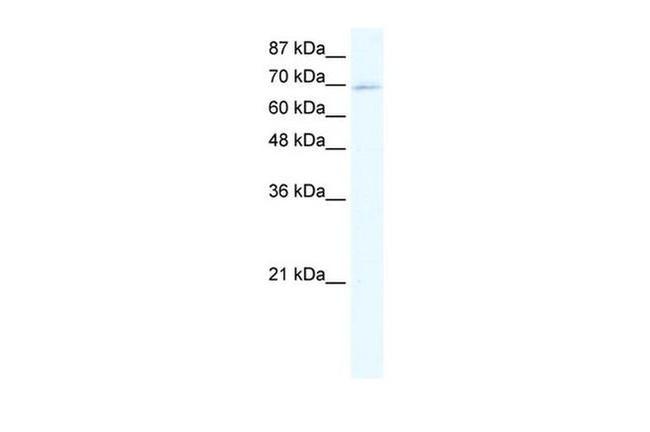 ZNF750 Antibody in Western Blot (WB)