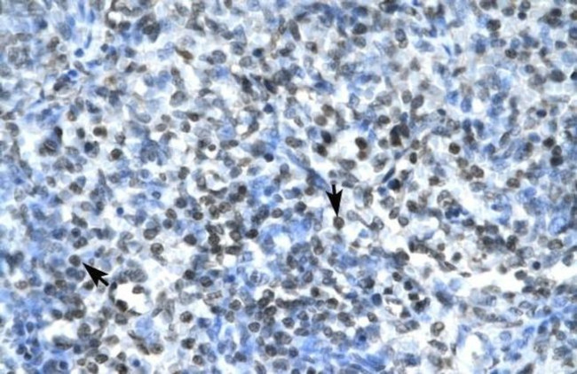 Claudin 17 Antibody in Immunohistochemistry (IHC)