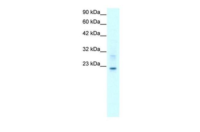 Claudin 9 Antibody in Western Blot (WB)