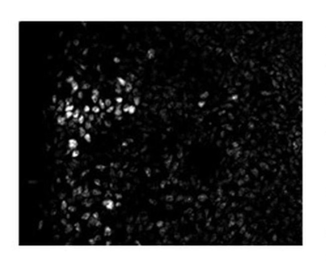 ZEB2 Antibody in Immunohistochemistry (IHC)
