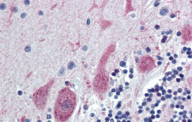 ST18 Antibody in Immunohistochemistry (IHC)