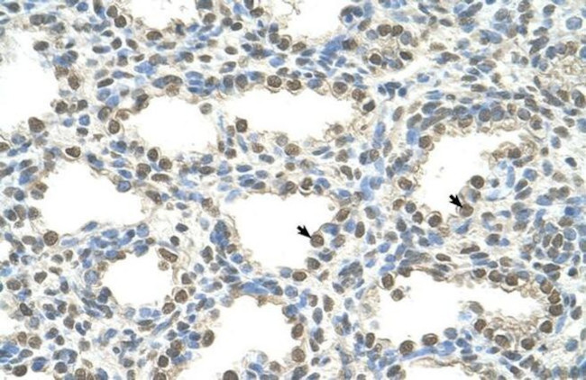 FOXQ1 Antibody in Immunohistochemistry (IHC)