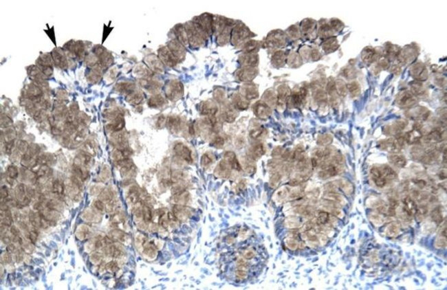 ASGR2 Antibody in Immunohistochemistry (Paraffin) (IHC (P))