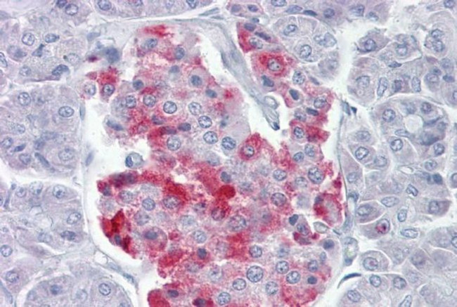 PCSK1 Antibody in Immunohistochemistry (IHC)