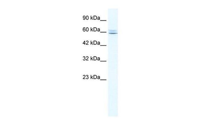 MTG16 Antibody in Western Blot (WB)
