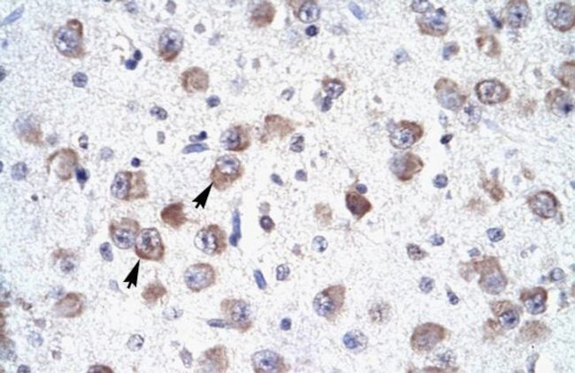 RALY Antibody in Immunohistochemistry (IHC)