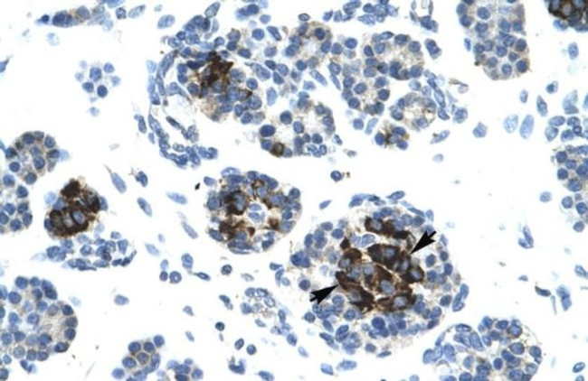 DNA Ligase IV Antibody in Immunohistochemistry (IHC)