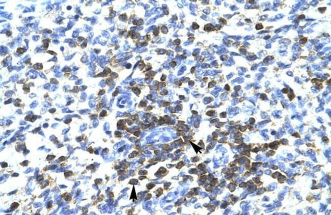 RCOR3 Antibody in Immunohistochemistry (IHC)