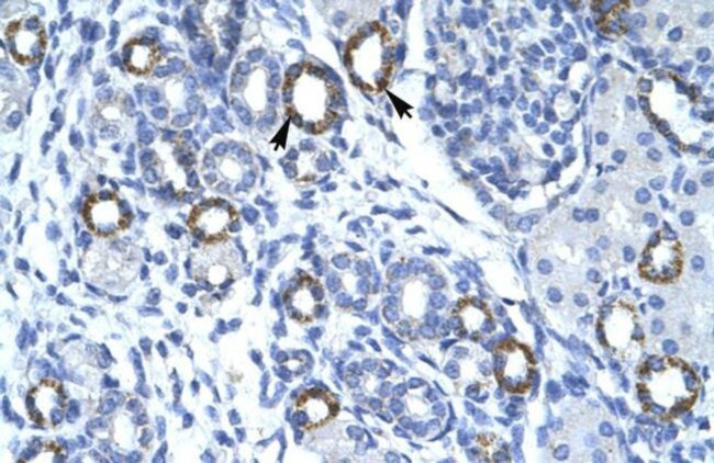 TMEM259 Antibody in Immunohistochemistry (IHC)