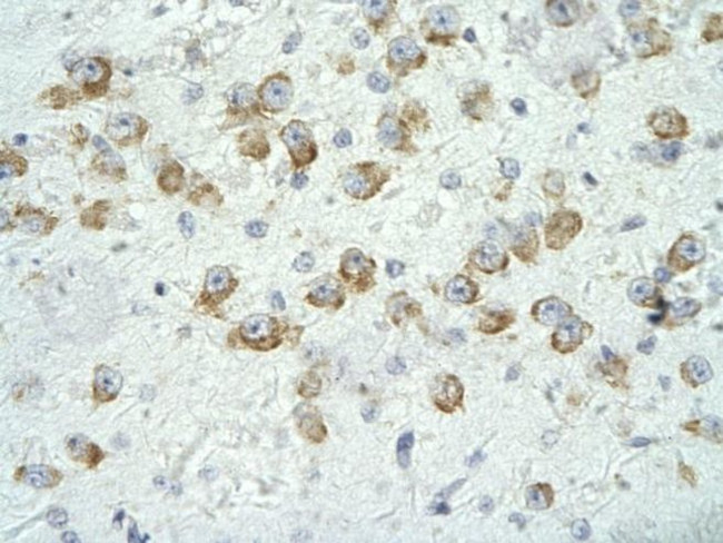 MED17 Antibody in Immunohistochemistry (Paraffin) (IHC (P))