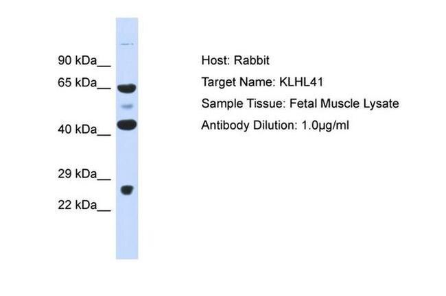 KLHL41 Antibody in Western Blot (WB)