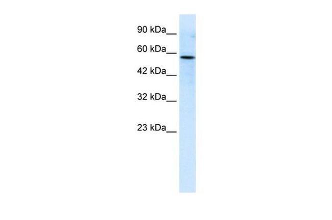 RIPX Antibody in Western Blot (WB)