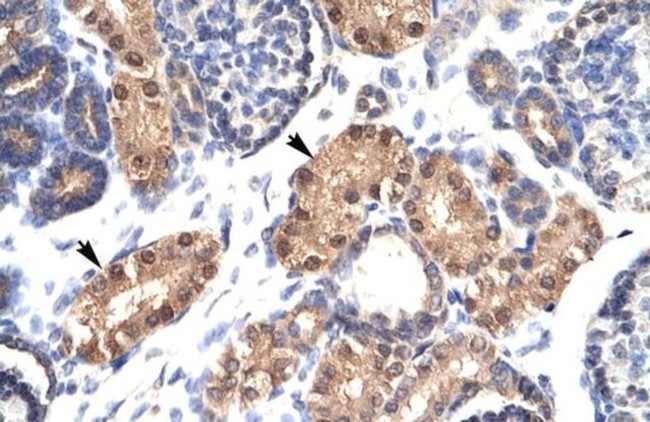 ZFPL1 Antibody in Immunohistochemistry (IHC)