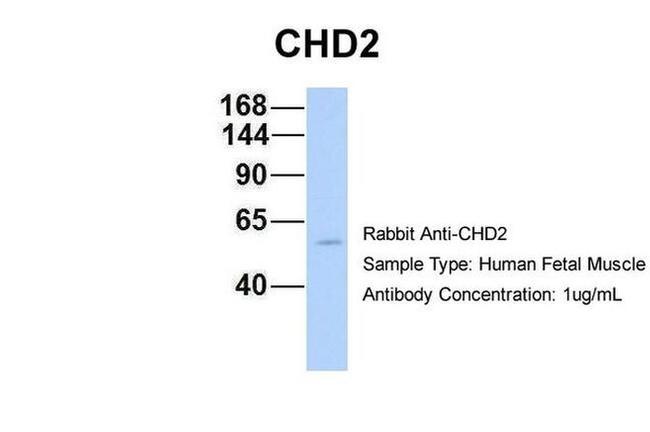 CHD2 Antibody in Western Blot (WB)