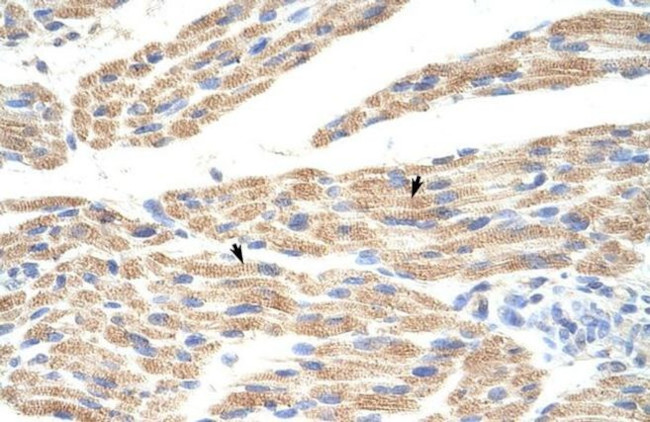 CNPY3 Antibody in Immunohistochemistry (IHC)