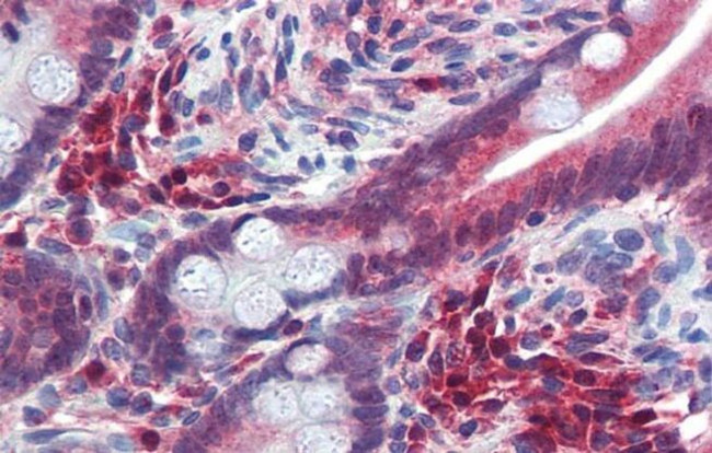 TRIM35 Antibody in Immunohistochemistry (IHC)