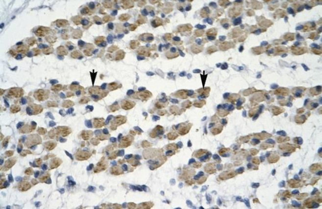 TRIM68 Antibody in Immunohistochemistry (IHC)