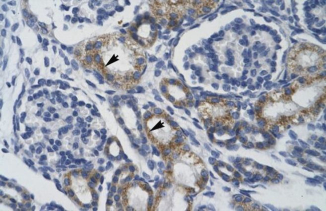 TRIM68 Antibody in Immunohistochemistry (IHC)