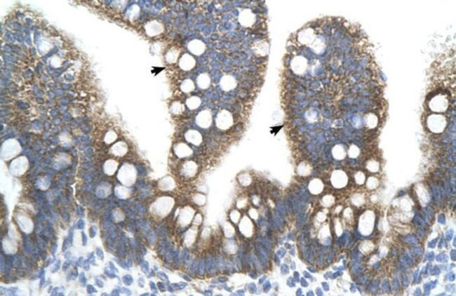 TFB2M Antibody in Immunohistochemistry (IHC)