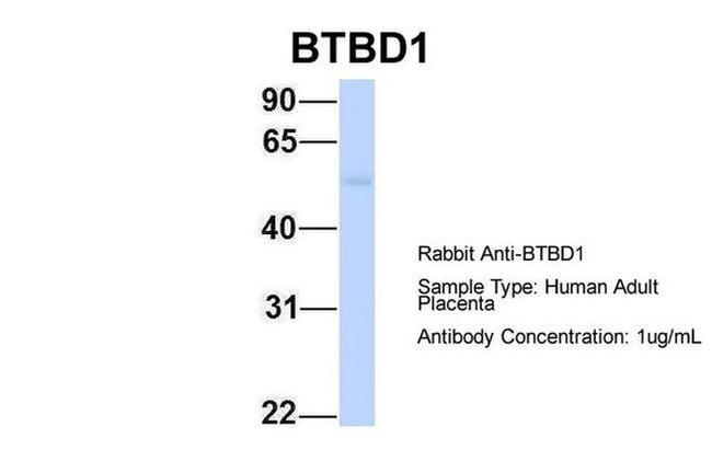 BTBD1 Antibody in Western Blot (WB)