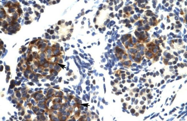 TRIM41 Antibody in Immunohistochemistry (IHC)